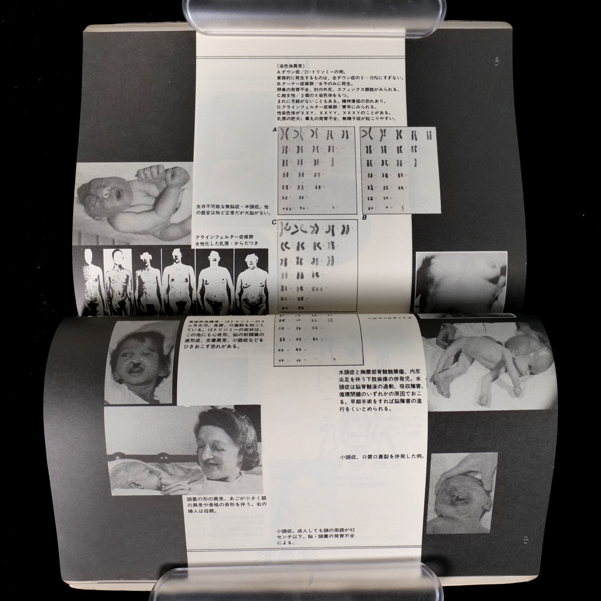 Yaso No.10 Monsters & Deformities (1983)
